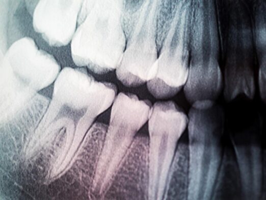 Obraz przedstawia rentgenodiagnostykę w klinikach 'Moje Ząbki', gdzie zaawansowane technologie i doświadczeni specjaliści łączą się, aby zapewnić pacjentom najwyższą jakość diagnostyki radiologicznej. Skorzystaj z nowoczesnych rozwiązań dla Twojego zdrowia.